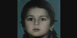 تعبیر خواب صورت و زیبا شدن صورت دختر مجرد و صورت جوش زده و زخمی