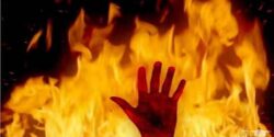 تعبیر خواب آتش گرفتن انسان و مادر و انسان و پدر و آتش گرفتن صورت و پا و فرزند