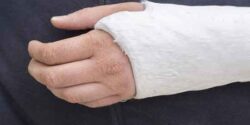 تعبیر خواب دست شکسته ابن سیرین و دست شکسته چپ و شکستن دست امام صادق