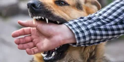 تعبیر خواب گاز گرفتن دست توسط سگ + گاز گرفتن دست توسط سگ و خون آمدن