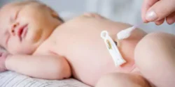 تعبیر خواب ناف نوزاد + تمیز کردن ناف نوزاد و بریدن ناف نوزاد و ناف نوزاد خونی