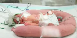 تعبیر خواب زایمان بچه نارس + زنده ماندن بچه نارس بعد از زایمان و مراقبت از بچه نارس