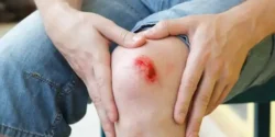 تعبیر خواب زانو زخمی + برای زن متاهل و بادار و دختر مجرد