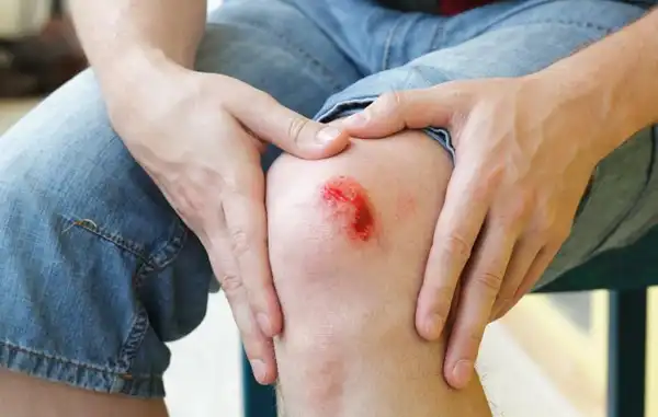 تعبیر خواب زانو زخمی + برای زن متاهل و بادار و دختر مجرد